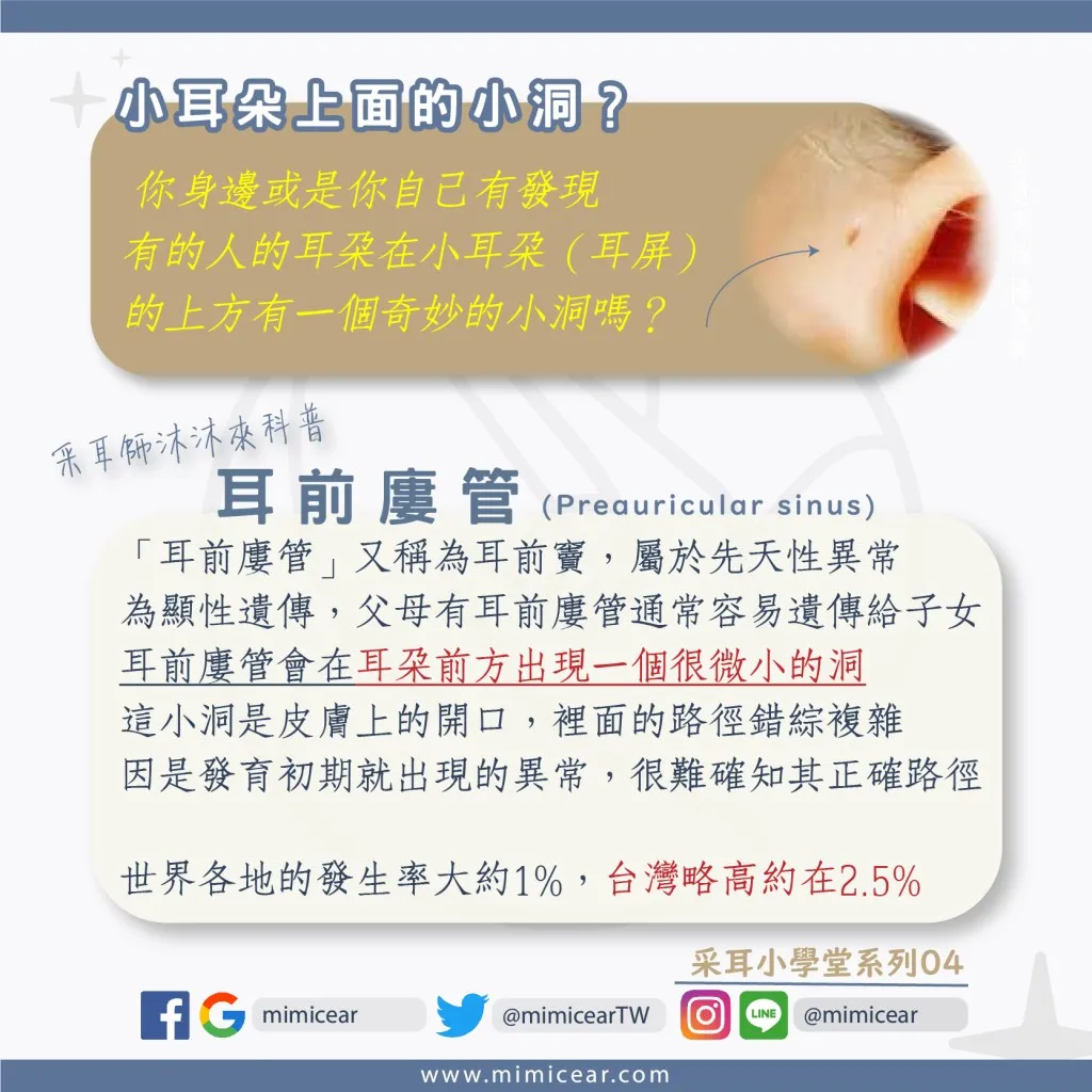 耳前廔管_耳朵上的小孔