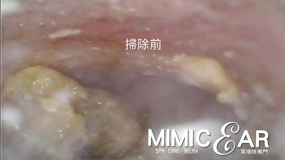 inner ear scope