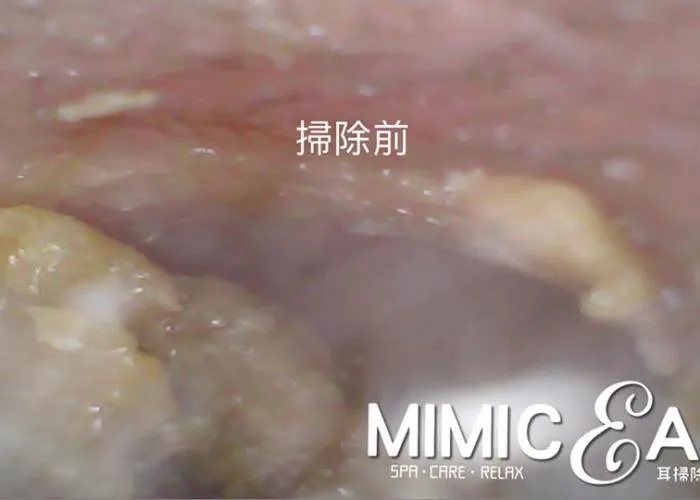 inner ear scope