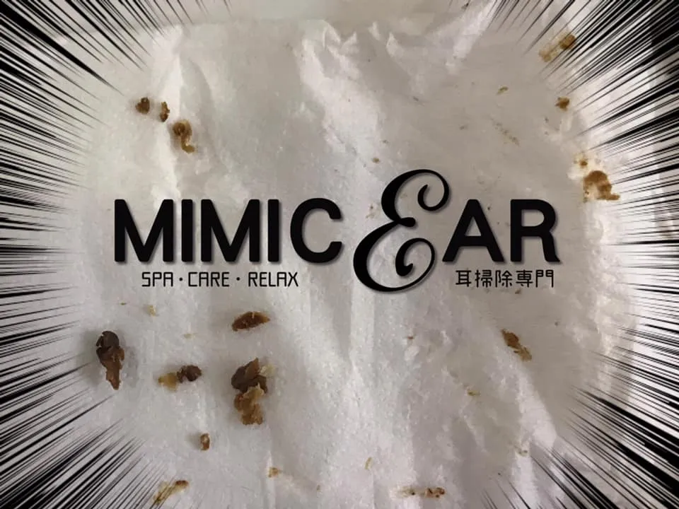 earwaxmimicear001