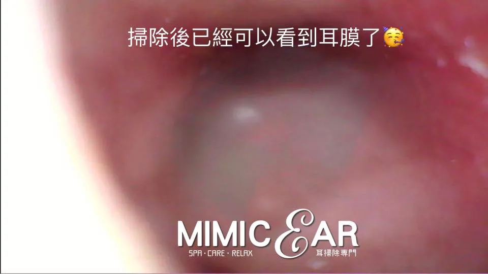 inner ear scope