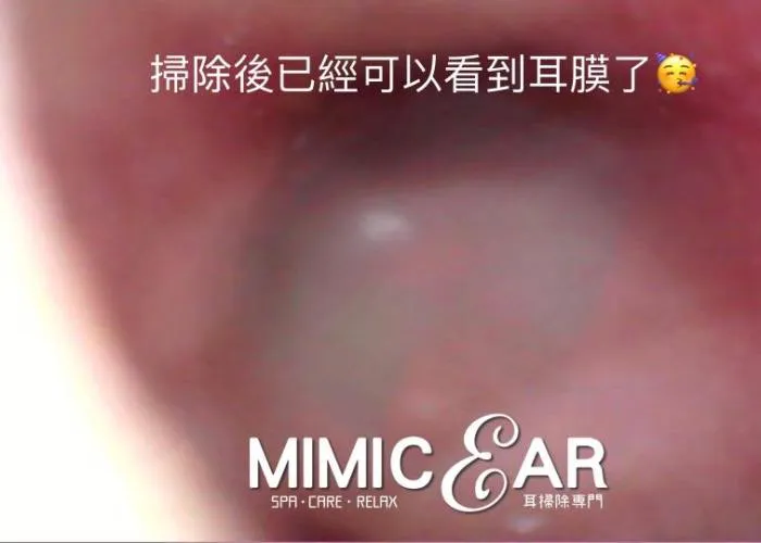 inner ear scope